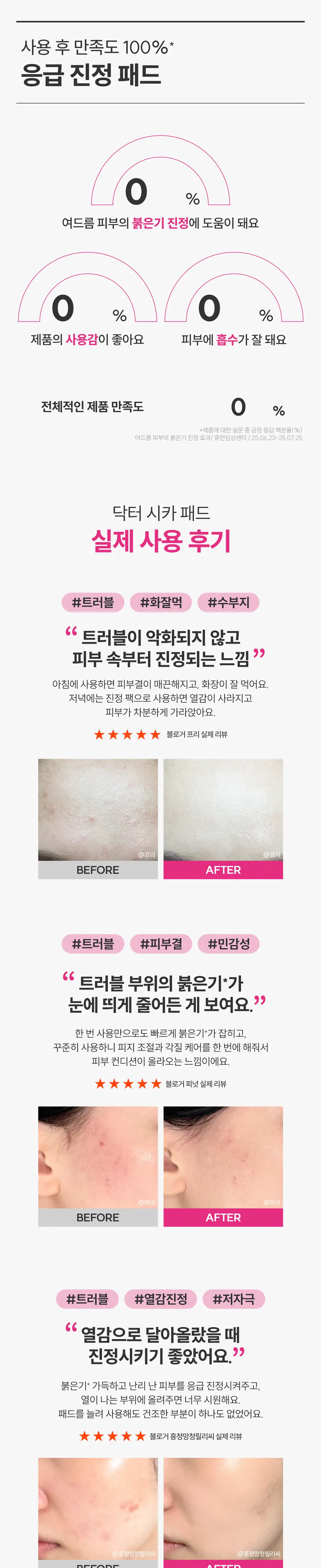[응급진정/트러블케어] 로벡틴 닥터 마스크 시카 블레미쉬 토너 패드 60매 기획 (+10매) 상세페이지 20